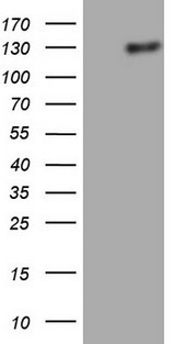 LPIN1 / Lipin 1 Antibody - HEK293T cells were transfected with the pCMV6-ENTRY control. (Left lane) or pCMV6-ENTRY LPIN1. (Right lane) cDNA for 48 hrs and lysed. Equivalent amounts of cell lysates. (5 ug per lane) were separated by SDS-PAGE and immunoblotted with anti-LPIN1.