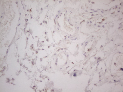 LPIN1 / Lipin 1 Antibody - Immunohistochemical staining of paraffin-embedded Human bladder tissue within the normal limits using anti-LPIN1 mouse monoclonal antibody. (Heat-induced epitope retrieval by Tris-EDTA, pH8.0) Dilution: 1:150