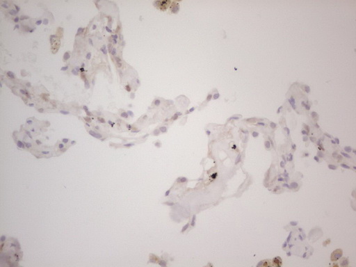 LPIN1 / Lipin 1 Antibody - Immunohistochemical staining of paraffin-embedded Human lung tissue within the normal limits using anti-LPIN1 mouse monoclonal antibody. (Heat-induced epitope retrieval by Tris-EDTA, pH8.0) Dilution: 1:150