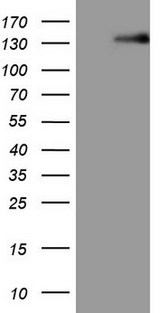 LPIN1 / Lipin 1 Antibody - HEK293T cells were transfected with the pCMV6-ENTRY control. (Left lane) or pCMV6-ENTRY LPIN1. (Right lane) cDNA for 48 hrs and lysed. Equivalent amounts of cell lysates. (5 ug per lane) were separated by SDS-PAGE and immunoblotted with anti-LPIN1.