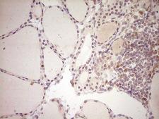 LPIN1 / Lipin 1 Antibody - Immunohistochemical staining of paraffin-embedded Human thyroid tissue within the normal limits using anti-LPIN1 mouse monoclonal antibody. (Heat-induced epitope retrieval by Tris-EDTA, pH8.0) Dilution: 1:150