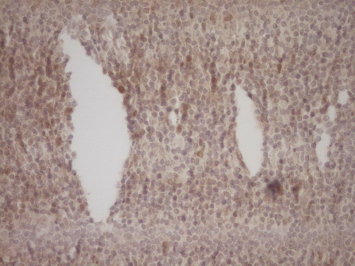 LPIN1 / Lipin 1 Antibody - Immunohistochemical staining of paraffin-embedded Human tonsil within the normal limits using anti-LPIN1 mouse monoclonal antibody. (Heat-induced epitope retrieval by Tris-EDTA, pH8.0) Dilution: 1:150