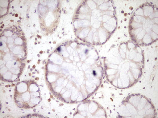 LPIN1 / Lipin 1 Antibody - Immunohistochemical staining of paraffin-embedded Human colon tissue within the normal limits using anti-LPIN1 mouse monoclonal antibody. (Heat-induced epitope retrieval by Tris-EDTA, pH8.0) Dilution: 1:150