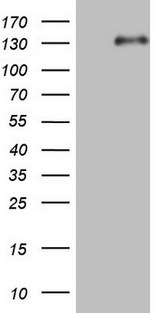 LPIN1 / Lipin 1 Antibody - HEK293T cells were transfected with the pCMV6-ENTRY control. (Left lane) or pCMV6-ENTRY LPIN1. (Right lane) cDNA for 48 hrs and lysed. Equivalent amounts of cell lysates. (5 ug per lane) were separated by SDS-PAGE and immunoblotted with anti-LPIN1.