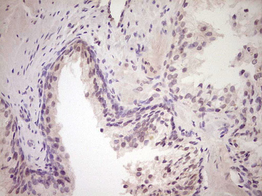 LPIN1 / Lipin 1 Antibody - Immunohistochemical staining of paraffin-embedded Human prostate tissue within the normal limits using anti-LPIN1 mouse monoclonal antibody. (Heat-induced epitope retrieval by Tris-EDTA, pH8.0) Dilution: 1:150