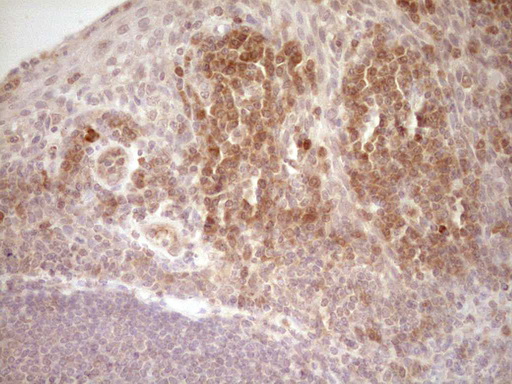 LPIN1 / Lipin 1 Antibody - Immunohistochemical staining of paraffin-embedded Human tonsil within the normal limits using anti-LPIN1 mouse monoclonal antibody. (Heat-induced epitope retrieval by Tris-EDTA, pH8.0) Dilution: 1:150