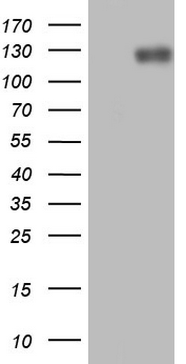 LPIN1 / Lipin 1 Antibody - HEK293T cells were transfected with the pCMV6-ENTRY control. (Left lane) or pCMV6-ENTRY LPIN1. (Right lane) cDNA for 48 hrs and lysed. Equivalent amounts of cell lysates. (5 ug per lane) were separated by SDS-PAGE and immunoblotted with anti-LPIN1.