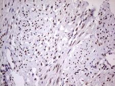 LPIN1 / Lipin 1 Antibody - Immunohistochemical staining of paraffin-embedded Human endometrium tissue within the normal limits using anti-LPIN1 mouse monoclonal antibody. (Heat-induced epitope retrieval by 1 mM EDTA in 10mM Tris, pH8.5, 120C for 3min,