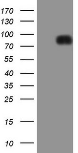 LPIN1 / Lipin 1 Antibody - HEK293T cells were transfected with the pCMV6-ENTRY control. (Left lane) or pCMV6-ENTRY LPIN1. (Right lane) cDNA for 48 hrs and lysed. Equivalent amounts of cell lysates. (5 ug per lane) were separated by SDS-PAGE and immunoblotted with anti-LPIN1. (1:2000)