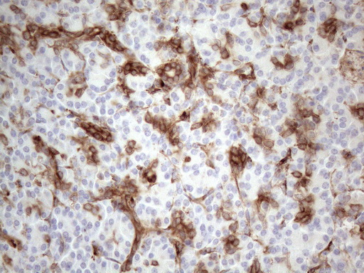 LPIN1 / Lipin 1 Antibody - Immunohistochemical staining of paraffin-embedded Human pancreas tissue within the normal limits using anti-LPIN1 mouse monoclonal antibody. (Heat-induced epitope retrieval by 1mM EDTA in 10mM Tris buffer. (pH8.5) at 120°C for 3 min. (1:150)