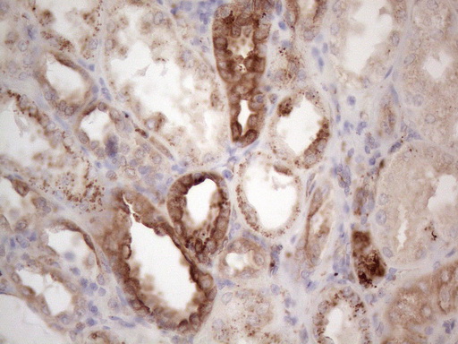 LPIN1 / Lipin 1 Antibody - Immunohistochemical staining of paraffin-embedded Human Kidney tissue within the normal limits using anti-LPIN1 mouse monoclonal antibody. (Heat-induced epitope retrieval by 1mM EDTA in 10mM Tris buffer. (pH8.5) at 120°C for 3 min. (1:150)