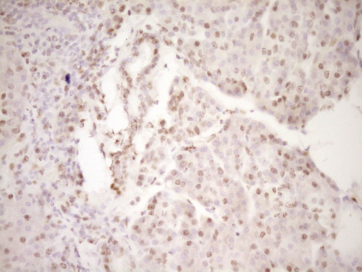 LPIN1 / Lipin 1 Antibody - Immunohistochemical staining of paraffin-embedded Human pancreas tissue within the normal limits using anti-LPIN1 mouse monoclonal antibody. (Heat-induced epitope retrieval by 1 mM EDTA in 10mM Tris, pH8.5, 120C for 3min,