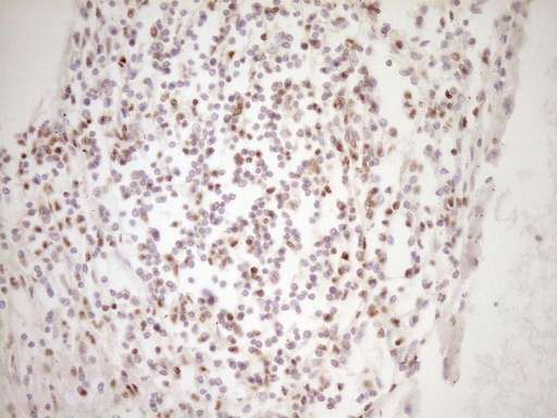 LPIN1 / Lipin 1 Antibody - Immunohistochemical staining of paraffin-embedded Human thyroid tissue within the normal limits using anti-LPIN1 mouse monoclonal antibody. (Heat-induced epitope retrieval by 1 mM EDTA in 10mM Tris, pH8.5, 120C for 3min,