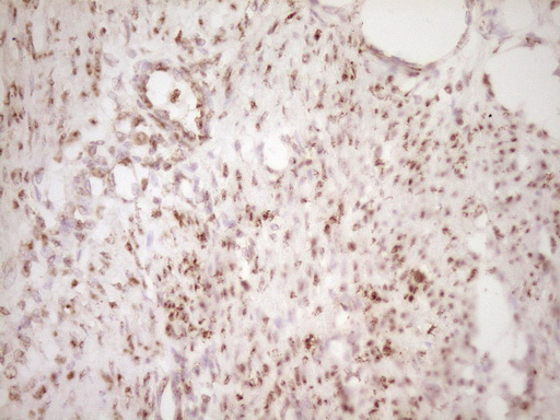LPIN1 / Lipin 1 Antibody - Immunohistochemical staining of paraffin-embedded Human endometrium tissue within the normal limits using anti-LPIN1 mouse monoclonal antibody. (Heat-induced epitope retrieval by 1 mM EDTA in 10mM Tris, pH8.5, 120C for 3min,