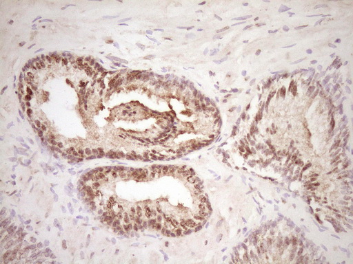 LPIN1 / Lipin 1 Antibody - Immunohistochemical staining of paraffin-embedded Human prostate tissue within the normal limits using anti-LPIN1 mouse monoclonal antibody. (Heat-induced epitope retrieval by 1 mM EDTA in 10mM Tris, pH8.5, 120C for 3min,