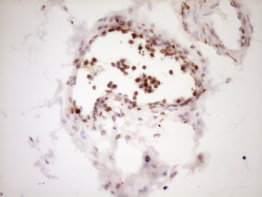 LPIN1 / Lipin 1 Antibody - Immunohistochemical staining of paraffin-embedded Human bladder tissue within the normal limits using anti-LPIN1 mouse monoclonal antibody. (Heat-induced epitope retrieval by 1 mM EDTA in 10mM Tris, pH8.5, 120C for 3min,
