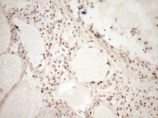 LPIN1 / Lipin 1 Antibody - Immunohistochemical staining of paraffin-embedded Human lymph node tissue within the normal limits using anti-LPIN1 mouse monoclonal antibody. (Heat-induced epitope retrieval by 1 mM EDTA in 10mM Tris, pH8.5, 120C for 3min,