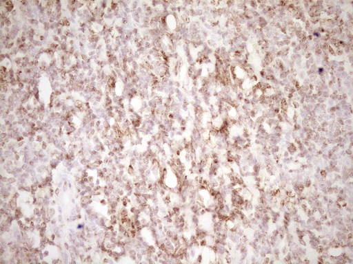 LPIN1 / Lipin 1 Antibody - Immunohistochemical staining of paraffin-embedded Human tonsil within the normal limits using anti-LPIN1 mouse monoclonal antibody. (Heat-induced epitope retrieval by 1 mM EDTA in 10mM Tris, pH8.5, 120C for 3min,