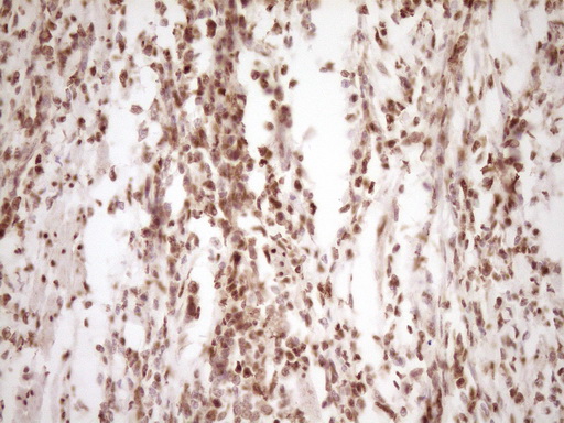 LPIN1 / Lipin 1 Antibody - Immunohistochemical staining of paraffin-embedded Human colon tissue within the normal limits using anti-LPIN1 mouse monoclonal antibody. (Heat-induced epitope retrieval by 1 mM EDTA in 10mM Tris, pH8.5, 120C for 3min,