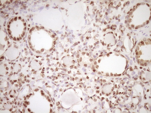 LPIN1 / Lipin 1 Antibody - Immunohistochemical staining of paraffin-embedded Human Kidney tissue within the normal limits using anti-LPIN1 mouse monoclonal antibody. (Heat-induced epitope retrieval by 1 mM EDTA in 10mM Tris, pH8.5, 120C for 3min,