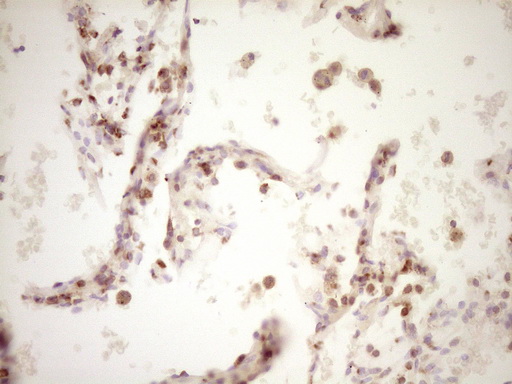 LPIN1 / Lipin 1 Antibody - Immunohistochemical staining of paraffin-embedded Human lung tissue within the normal limits using anti-LPIN1 mouse monoclonal antibody. (Heat-induced epitope retrieval by 1 mM EDTA in 10mM Tris, pH8.5, 120C for 3min,