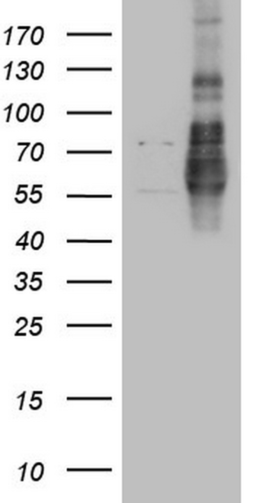 LPIN1 / Lipin 1 Antibody - HEK293T cells were transfected with the pCMV6-ENTRY control (Left lane) or pCMV6-ENTRY LPIN1 (Right lane) cDNA for 48 hrs and lysed. Equivalent amounts of cell lysates (5 ug per lane) were separated by SDS-PAGE and immunoblotted with anti-LPIN1.