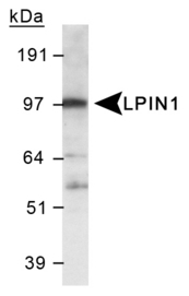 LPIN1 / Lipin 1 Antibody - Detection of LPIN1 in 3T3 L1 lysate using Rabbit Polyclonal anti-LPIN1 .  This image was taken for the unconjugated form of this product. Other forms have not been tested.