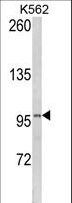 LPIN2 / Lipin 2 Antibody - Western blot of LPIN2 Antibody in K562 cell line lysates (35 ug/lane). LPIN2 (arrow) was detected using the purified antibody.(2 ug/ml)