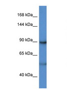 LPIN2 / Lipin 2 Antibody - LPIN2 / Lipin 2 antibody Western blot of HeLa Cell lysate. Antibody concentration 1 ug/ml.  This image was taken for the unconjugated form of this product. Other forms have not been tested.