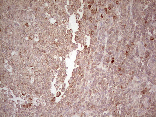 LPIN3 / Lipin-3 Antibody - Immunohistochemical staining of paraffin-embedded Human tonsil within the normal limits using anti-LPIN3 mouse monoclonal antibody. (Heat-induced epitope retrieval by 1 mM EDTA in 10mM Tris, pH8.5, 120C for 3min,