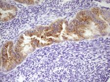 LPIN3 / Lipin-3 Antibody - Immunohistochemical staining of paraffin-embedded Human endometrium tissue within the normal limits using anti-LPIN3 mouse monoclonal antibody. (Heat-induced epitope retrieval by 1 mM EDTA in 10mM Tris, pH8.5, 120C for 3min,