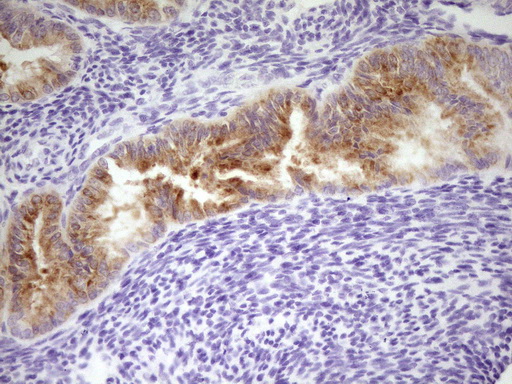 LPIN3 / Lipin-3 Antibody - IHC of paraffin-embedded Human endometrium tissue using anti-LPIN3 mouse monoclonal antibody. (Heat-induced epitope retrieval by 1 mM EDTA in 10mM Tris, pH8.5, 120°C for 3min).