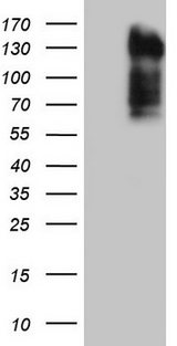 LPIN3 / Lipin-3 Antibody - HEK293T cells were transfected with the pCMV6-ENTRY control (Left lane) or pCMV6-ENTRY LPIN3 (Right lane) cDNA for 48 hrs and lysed. Equivalent amounts of cell lysates (5 ug per lane) were separated by SDS-PAGE and immunoblotted with anti-LPIN3.