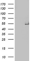 LPL / Lipoprotein Lipase Antibody - HEK293T cells were transfected with the pCMV6-ENTRY control (Left lane) or pCMV6-ENTRY LPL (Right lane) cDNA for 48 hrs and lysed. Equivalent amounts of cell lysates (5 ug per lane) were separated by SDS-PAGE and immunoblotted with anti-LPL.