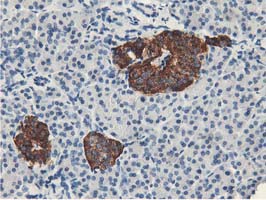 LPL / Lipoprotein Lipase Antibody - IHC of paraffin-embedded Human pancreas tissue using anti-LPL mouse monoclonal antibody. (Heat-induced epitope retrieval by 10mM citric buffer, pH6.0, 100C for 10min).