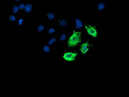 LPL / Lipoprotein Lipase Antibody - Anti-LPL mouse monoclonal antibody immunofluorescent staining of COS7 cells transiently transfected by pCMV6-ENTRY LPL.
