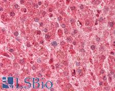 LPL / Lipoprotein Lipase Antibody - Human Liver: Formalin-Fixed, Paraffin-Embedded (FFPE).  This image was taken for the unconjugated form of this product. Other forms have not been tested.