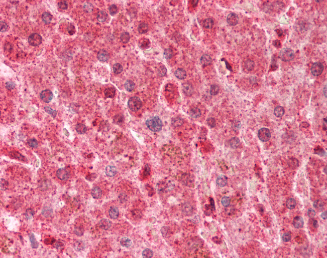 LPL / Lipoprotein Lipase Antibody - Human Liver: Formalin-Fixed, Paraffin-Embedded (FFPE).  This image was taken for the unconjugated form of this product. Other forms have not been tested.