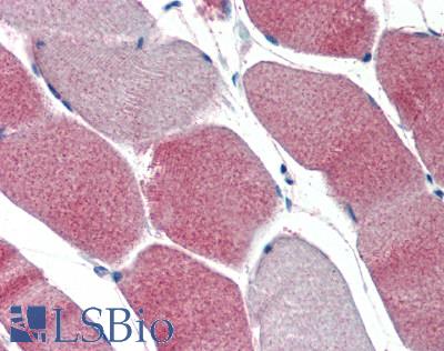 LPL / Lipoprotein Lipase Antibody - Human Skeletal Muscle: Formalin-Fixed, Paraffin-Embedded (FFPE)
