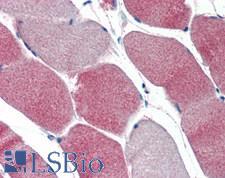 LPL / Lipoprotein Lipase Antibody - Human Skeletal Muscle: Formalin-Fixed, Paraffin-Embedded (FFPE)