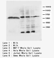 LPL / Lipoprotein Lipase Antibody -  This image was taken for the unconjugated form of this product. Other forms have not been tested.
