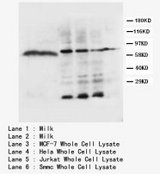 LPL / Lipoprotein Lipase Antibody -  This image was taken for the unconjugated form of this product. Other forms have not been tested.