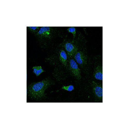 LPL / Lipoprotein Lipase Antibody