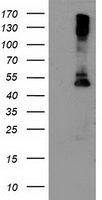 LPL / Lipoprotein Lipase Antibody - HEK293T cells were transfected with the pCMV6-ENTRY control (Left lane) or pCMV6-ENTRY LPL (Right lane) cDNA for 48 hrs and lysed. Equivalent amounts of cell lysates (5 ug per lane) were separated by SDS-PAGE and immunoblotted with anti-LPL.
