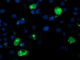 LPL / Lipoprotein Lipase Antibody - Anti-LPL mouse monoclonal antibody immunofluorescent staining of COS7 cells transiently transfected by pCMV6-ENTRY LPL.