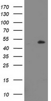 LPL / Lipoprotein Lipase Antibody - HEK293T cells were transfected with the pCMV6-ENTRY control (Left lane) or pCMV6-ENTRY LPL (Right lane) cDNA for 48 hrs and lysed. Equivalent amounts of cell lysates (5 ug per lane) were separated by SDS-PAGE and immunoblotted with anti-LPL.