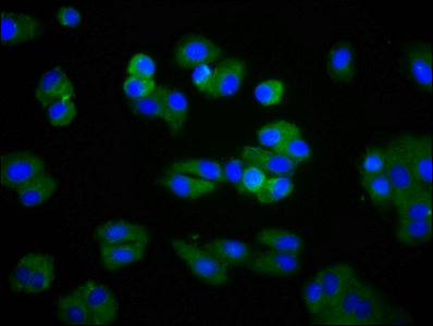 LPL / Lipoprotein Lipase Antibody - Immunofluorescence staining of HepG2 cells diluted at 1:266, counter-stained with DAPI. The cells were fixed in 4% formaldehyde, permeabilized using 0.2% Triton X-100 and blocked in 10% normal Goat Serum. The cells were then incubated with the antibody overnight at 4°C.The Secondary antibody was Alexa Fluor 488-congugated AffiniPure Goat Anti-Rabbit IgG (H+L).