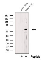LPL / Lipoprotein Lipase Antibody - Western blot analysis of extracts of mouse liver tissue using LIPL antibody. The lane on the left was treated with blocking peptide.