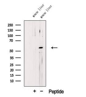 LPL / Lipoprotein Lipase Antibody - Western blot analysis of extracts of mouse liver tissue using LIPL antibody. The lane on the left was treated with blocking peptide.