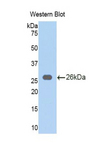 LPO / Lactoperoxidase Antibody - Western blot of recombinant LPO / Lactoperoxidase.  This image was taken for the unconjugated form of this product. Other forms have not been tested.